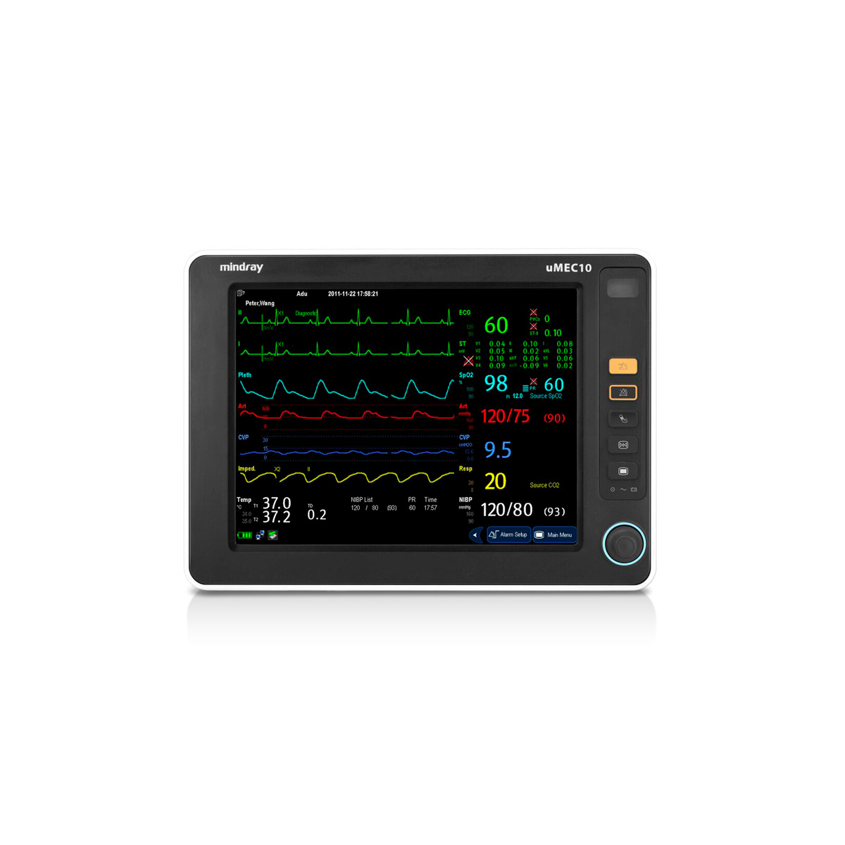 Monitor de Signos Vitales Multiparamétrico